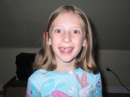 Mandi loses tooth